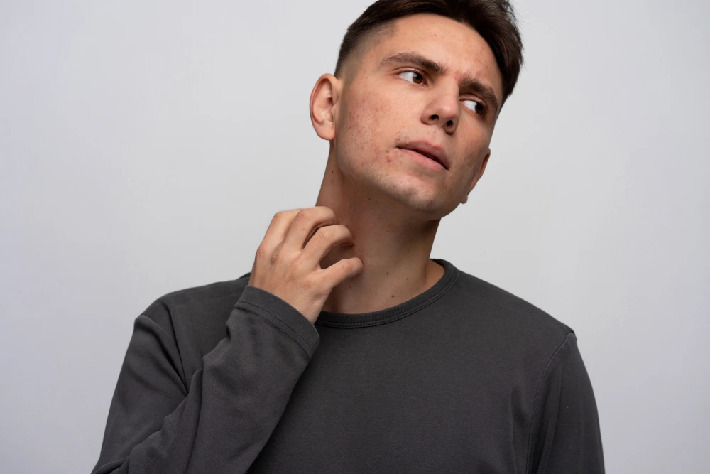 Folikülit (Kıl Kökü İltihabı)